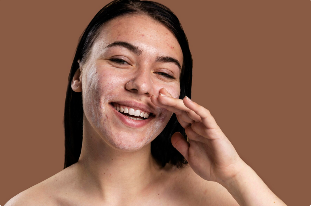 The Skinimalism Trend — Embracing Your Natural Skin