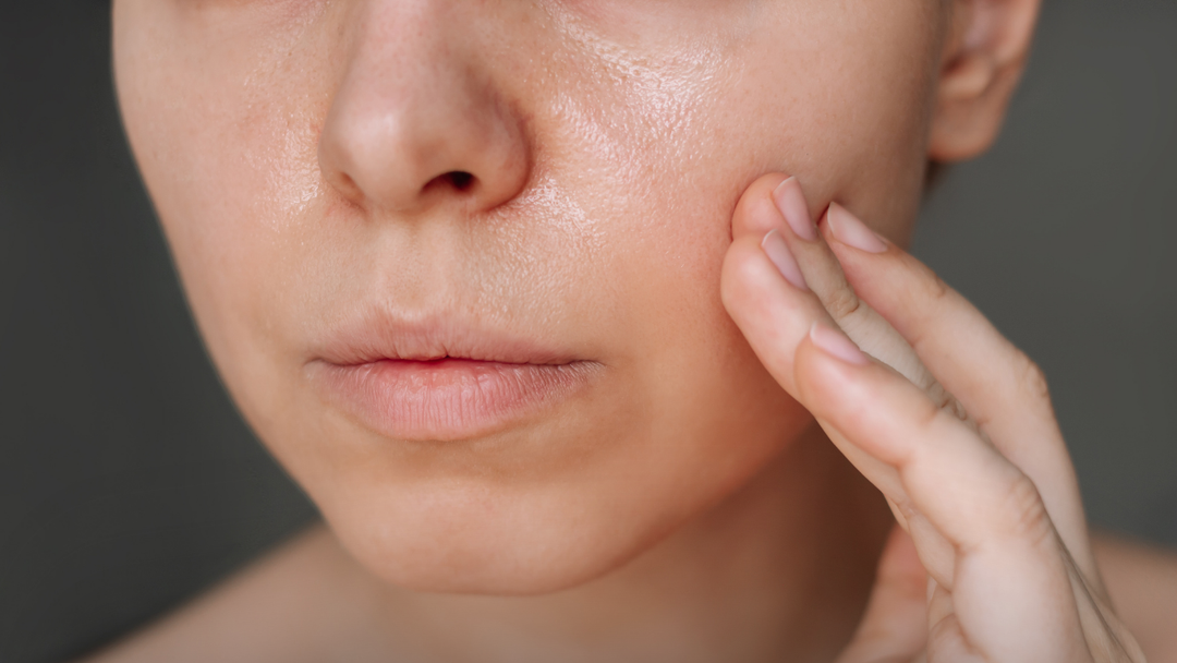 Best Skincare Routine for Oily Skin in 2025